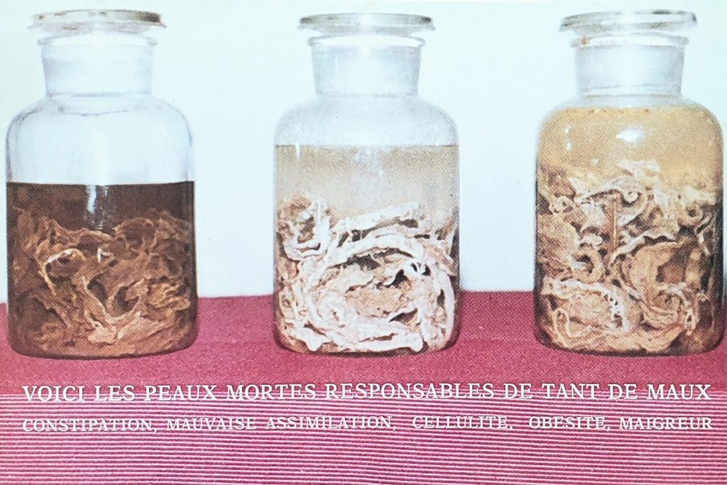 Histoire Peaux mortes